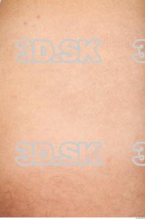 Skin texture of Moric 0004